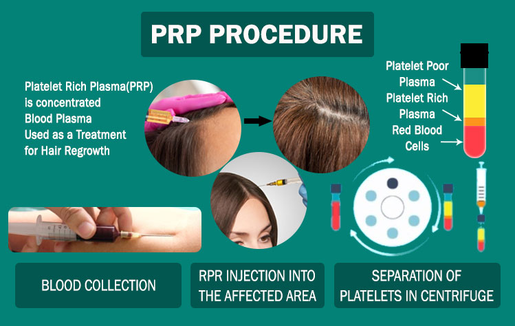 Platelet Rich Plasma Therapy(PRP)